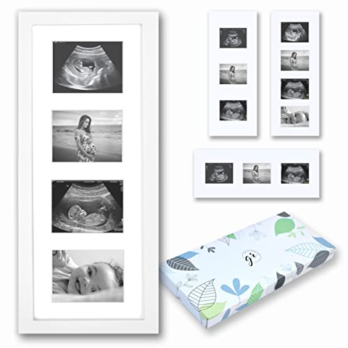 Image of Grehge Baby Ultrasound Picture Frame | Electronics Wireless Earbuds, Bluetooth Headphones Wireless Headphones