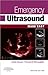 Emergency Ultrasound Made Easy, 2e