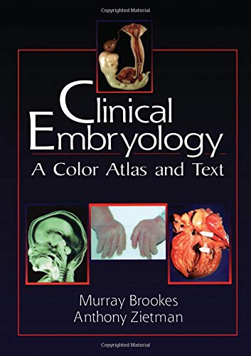 Clinical Embryology: A Color Atlas and Text