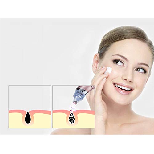 Aisence Removedor de cravos elétrico, sucção a vácuo