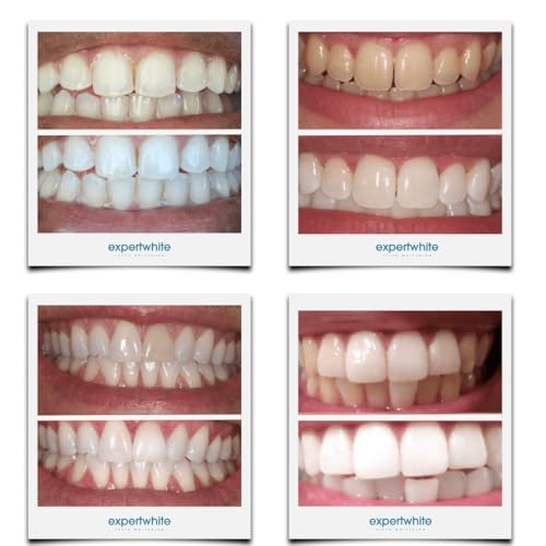 Image of 44% Teeth Whitening Gel - Refills for Trays - Professional Strength Carbamide Petoxide Syringes, 4 x 3cc, 15-Minute Treatment, Gels Only (No Trays)