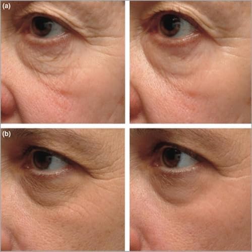 Instant Firming Eye Serum, Anti-Aging Formula for Under Bags and Wrinkles, Under Eye Cream, Wrinkle Filler, Visibly Improves for Bags Dark Circles Treatment for Puffines (0.49 Fl Oz, 2) - 3