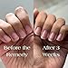 Botanist The Remedy | Nail Strengthening Polish | Repairs & Hardens Nails Damaged from Acrylics, Dip & Gel Manicures | Non-Toxic, 84% Plant Based, 21-Free & Vegan (Rose)