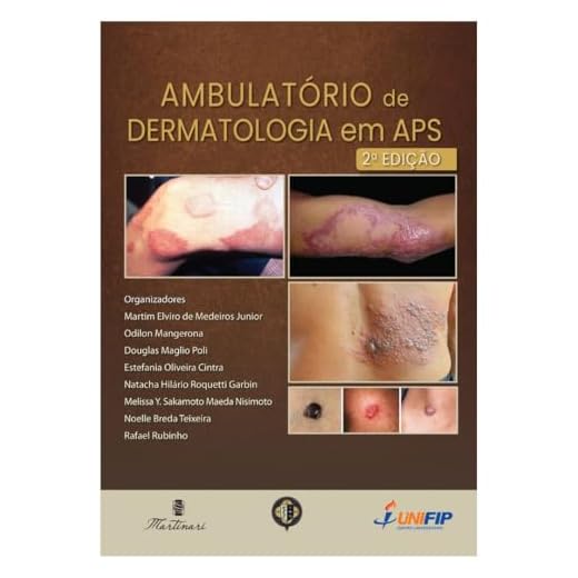 Ambulatório de Dermatologia em APS – Guia Prático de Dermatologia: Diagnóstico, Conduta e Casos Práticos