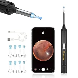 VITCOCO Ear Wax Removal Kit Ear Camera 1296P High-Definition Earwax Cleaner Portable USB Charging Visible 6 LED Otoscope…