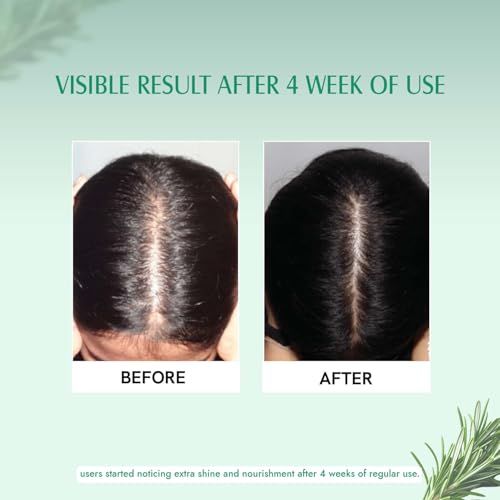 Aravi Organic Rosemary Essential Oil for Hair Growth,Quick Hair Growth Rosemary Oil for Women and Men - 100% Pure Rosemary Leaves Oil - 15 ml - Image 6