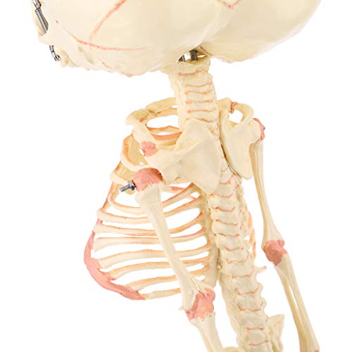 Modèle anatomique de squelette de bébé déformé pour recherche médicale - 3