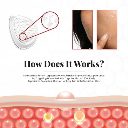 Image of Derma Smooth Skin Tag Removal - 72Patches | Gentle & Effective Skin Tag Remover for All Skin Types (72 UNITSSS Patchess)