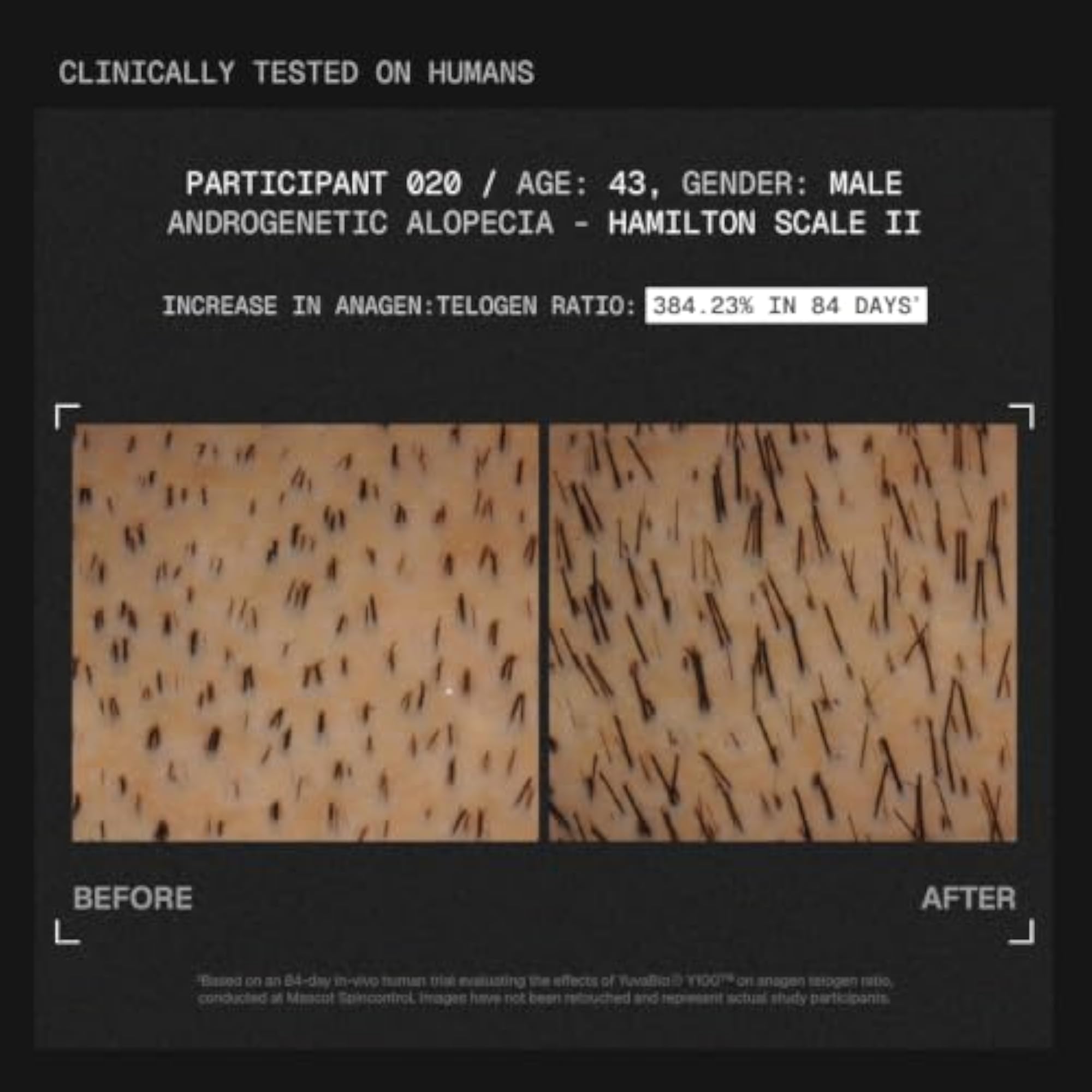MitoActive Mitochondrial Hair Growth Serum