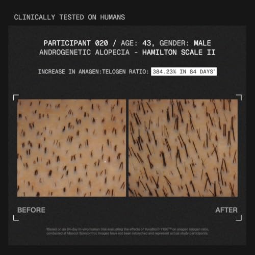 Image of Arata MitoActive | India's First Mitochondrial Hair Growth Serum | Reduces Hair Fall & Boosts Hair Growth | Powered by Y100 | Clinically Proven Active | In-Vivo Tested | For Men & Women | 30ml