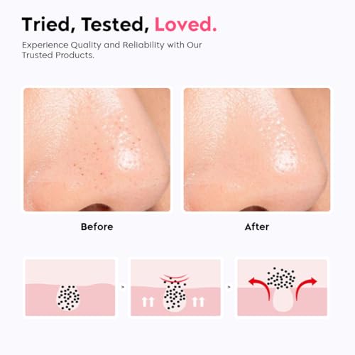 Image of Gleva Silicone Facial Cleansing Brush, Deep Pore Cleansing, Skin Exfoliator, Face Mask Applicator, Soft Silicone Bristles, Pink Bear Shape