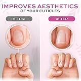 Coconut Nail Oil,Cuticle Remover,Nail Strengthener For Weak Na-Ils,N-Ail Growth And Strengthener,Roll-On Cuticle Softener For Na-Ils,Revitalizing For Nai-Ls Damage Dry Cut-Icle,(Coconut Flavour) - Image 2