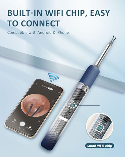 CozyZen S5 Ear Wax Removal Tool with 10 MP Camera, Omnidirectional Tweezers, 1080P HD Otoscope, 12 Ear Spoons, Wireless Ear Cleaner for iOS & Android with Light & Portable Case — view 5