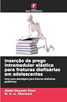 Inserção de prego intramedular elástico para fraturas diafisárias em adolescentes 6209279333 Book Cover