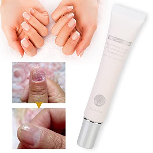 Nail Repair Cream, 20Ml Nail Cream Repair, Nail Strengthener, Finger Toe Nail Care Cream For Men And Women Home Use #TOP7