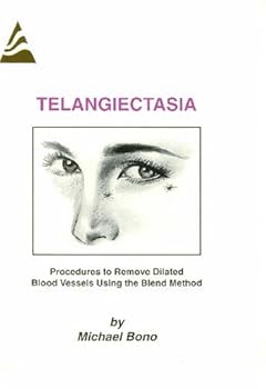 Spiral-bound Telangiectasia: Procedures to Remove Dilated Blood Vessels Using the Blend Method Book