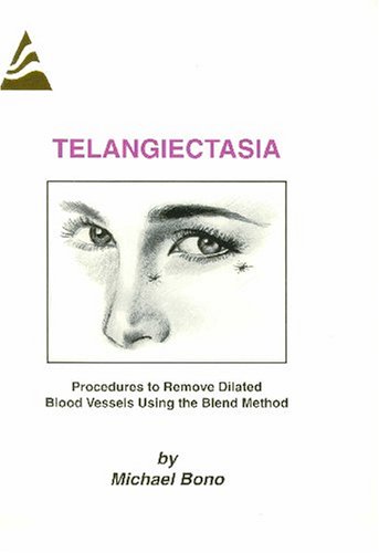 Telangiectasia: Procedures to Remove Dilated Blood Vessels Using the Blend Method