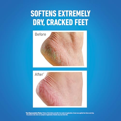 O'Keeffe's Healthy Feet Exfoliating Tube, 80ml – Foot Cream for Very Dry Skin, Cracked Heels and Feet | Softer Feet In One Use - Image 5
