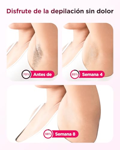 Depiladora Laser IPL con Refrigeración, Innovadora Función 3 en 1, 9 Niveles de Energía, 999,900 Flashes, Depiladora Luz Pulsada Indolora para Todo el Cuerpo 2 - imagen 4