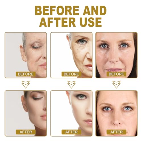 Ginseng Anti Wrinkle Serum, Ginseng Essence, Gold Ginseng Moisturizer, Polypeptide Anti-Wrinkle Ginseng Serum - Image 4