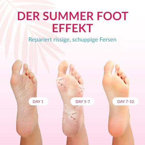 Summer Foot Premium Hornhaut-Entferner - Hornhaut Fußmaske für weiche Füße - Anti Hornhaut-Socken für effektive Fußpflege - dermatologisch… – Ansicht 5