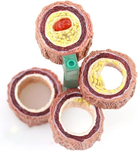 Modèle d'artère avec athérosclérose AMITD pour visualiser les plaques - 2