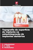Topografia da superfície do implante na osteointegração de implantes dentários (Portuguese Edition) 6208651050 Book Cover