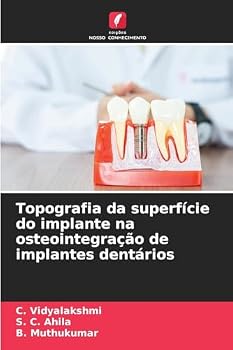 Topografia da superfície do implante na osteointegração de implantes dentários (Portuguese Edition)