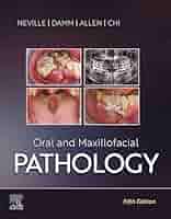 ORAL AND MAXILLOFACIAL SURGERY 第二版 Oral and Maxillofacial Surgery, 2nd Edition | Wiley