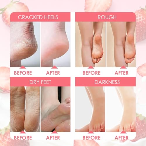 2 Paar Fußmaske-Hornhaut Entfernen Fuß-Erdbeer Peeling Fußmaske -Hornhaut Socken, Abgestorbene und Entfernt Effektiv-für sehr trockene Füße-Exfoliating Fussmaske für Männer und Frauen