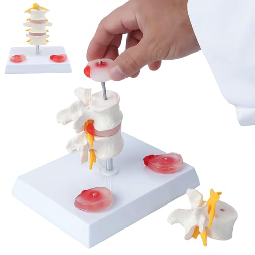 Image of 3 Section Lumbar Intervertebral Disc Human Skeleton Spine Model,Anatomical Vertebrae Model for Chiropractic,Patient Education Demonstration,Excellent Way for Demonstrating Disc