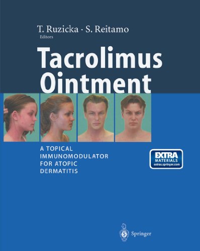 Tacrolimus Ointment: A Topical Immunomodulator for Atopic Dermatitis (English Edition)