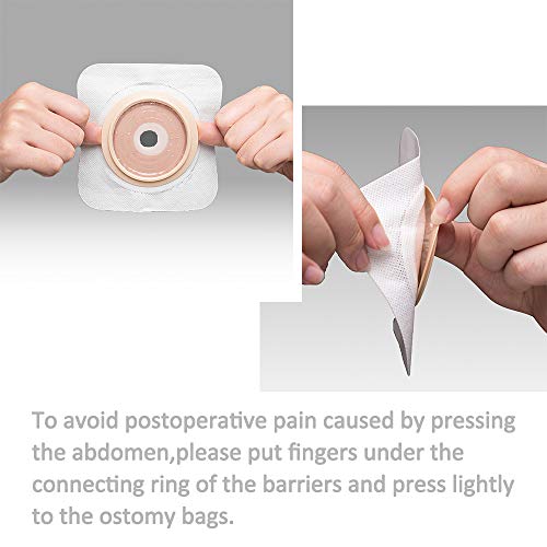 Carbou 21 Pcs Ostomy Supplies Colostomy Bags Two Piece Drainable Pouches With Closure 12", Ileostomy Stoma Care,Cut-To-Fit(15Pcs Bags+6Pcs Barrier) #TOP7