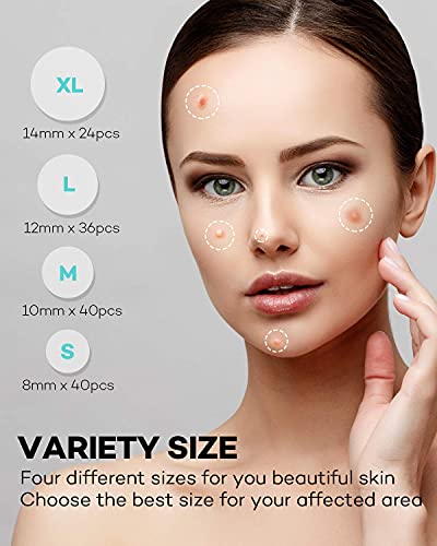 image for TKTK Acne Patch Pimple Patch, 4 Sizes 280 Patches Acne Absorbing Cover