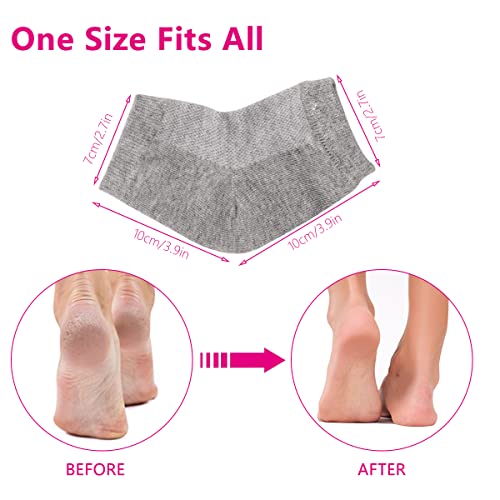 3 Pairs Moisturizing Gel Heel Socks Open Toe Socks Cracked Gel Heel Socks Foot Toeless Heel Repair Socks For Women Dry Hard Cracked Feet #TOP3
