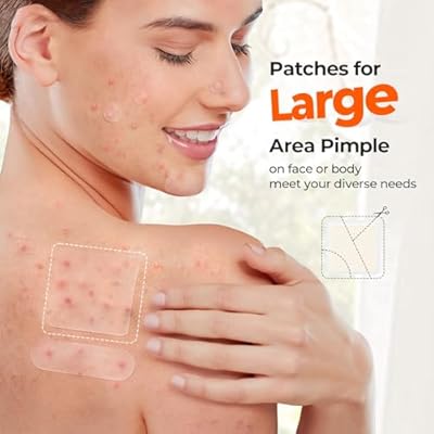 TKTK XL Contoured Hydrocolloid Chin Patches for Face 100 Count + Large Acne Patches for Face 120 Count, 8 Sizes Pimple Patch Bulk Face & Body, Odorless Acne Stickers