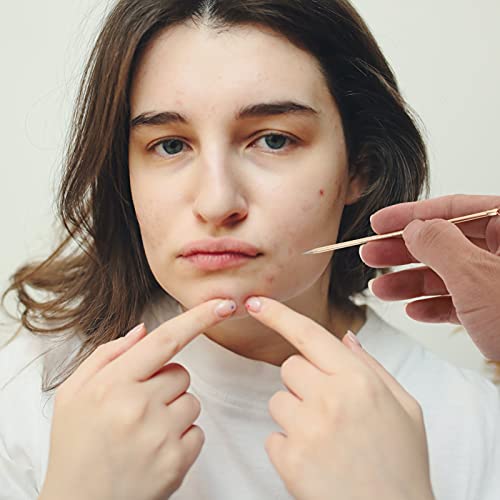 EXCEART 5Pcs Kit Ferramenta de Remoção de Extração Whitehead Cravo Blemish Pimple Agulha Em Aço Inox