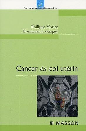Cancer du col utérin