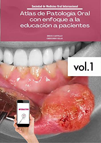 Atlas de Patología Oral con enfoque a la educación a pacientes (Spanish Edition)