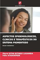 Aspectos Epidemiológicos, Clínicos E Terapêuticos Do Eritema Pigmentoso (Portuguese Edition) 6208990130 Book Cover