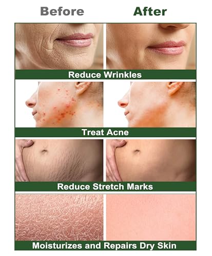 Castor Oil,2 Packs w/Free Lash&Brow Brushes&E-Book,100% Pure Hair Oil for Eyebrow Lash Eyelash Beard Growth Serum Dry Hair Skin Care Essential Oils,Gifts for Women Men Mum Wife Her - Image 6