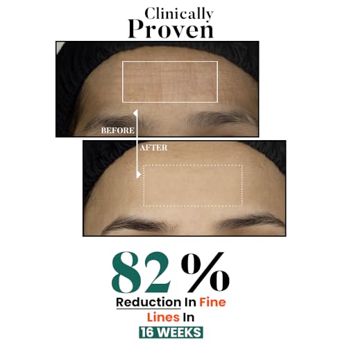 Image of Bio Code 0.1% Exosome & 0.4% PDRN Moisturizer (100ml) - For Anti-Ageing & Skin Regeneration | With 1.5% Peptide Complex, 1% Ceramide Complex & 0.5% Squalane | AI-Enhanced Formula | Dermatologist Recommended