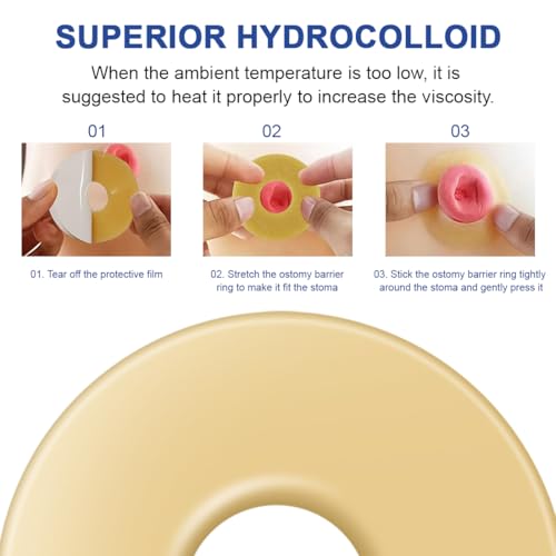 6 Stück Stoma Barriereringe 2mm Stomabeutel Stoma Barrier Tapes Absperrstreifen Selbstklebende Stomaversorgung für Kolostomiebeutel