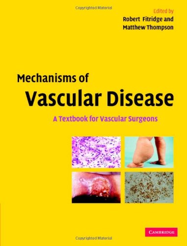 Buy Mechanisms Of Vascular Disease:A Textbook For Vascular Surgeons — BookShops.in