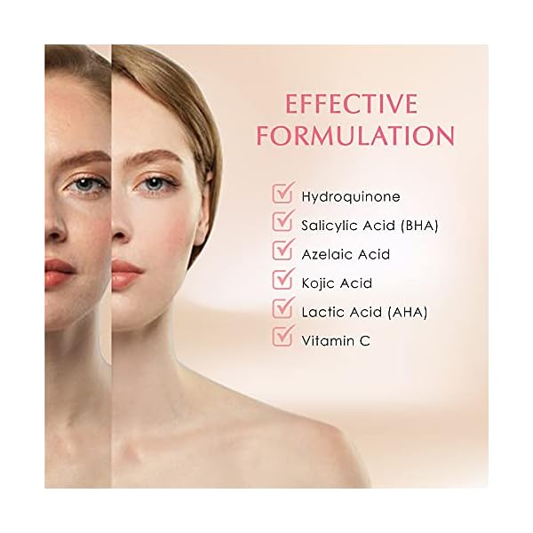 Dark-Spot-Remover-Corrector-for-Face-Body-Dark-Spot-Melasma-Hyperpigmentation-Sunspots-Treatment-Advanced-Ingredients-Kojic-Acid-Salicylic-Acid-Azelaic-Acid-and-Vitamin-C Dark Spot Remover Corrector for Face & Body - Dark Spot, Melasma, Hyperpigmentation & Sunspots Treatment - Advanced…