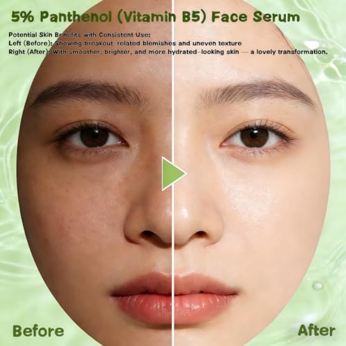 AFCRYIYE 5% Panthenol (Vitamin B5) Face Serum | Sensitive Skin Barrier Support, Hydrating Soothing Serum for Dry Skin, Strengthen Skin Barrier & Soothe Redness, Fragrance-Free for Delicate & Acne-Prone Skin