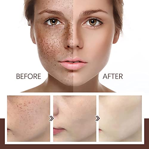 Canotun 878641303 Herbal Refining Peel-Off Facial Mask,Peel Off Mask Ginseng Korean Anti Aging,Pro-Herbal Refining Peel-Off Facial Mask thumb #3