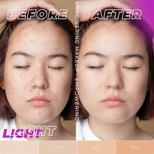 Image of Lamel- Oh My Clear Face Foundation- №401-Soft Beige |Acne Coverage - SPF-Enhanced | Salicylic Acid & Tea Tree Extract | Dewy & Flawless Finish | Sensitive Skin Care |Organic & Oil-Free | 40 ml