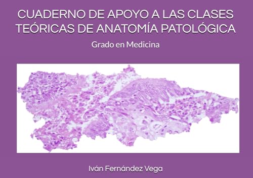 CUADERNO DE APOYO A LAS CLASES TEÓRICAS DE ANATOMÍA PATOLÓGICA: GRADO EN MEDICINA