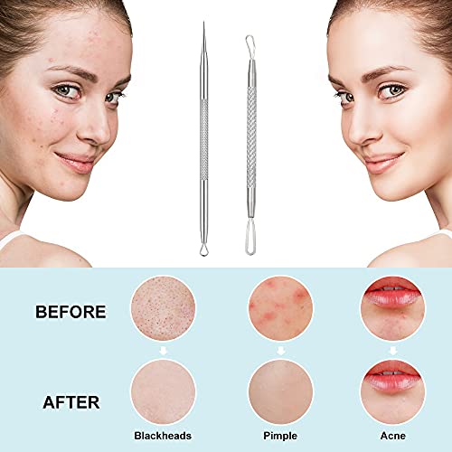 La Chat LC-BHR2 Blackhead Remover, 2 Pcs Pimple Popper ,Stainless Steel Pimple Extractor Blackhead Removal Tool Risk Free Treatment thumb #5